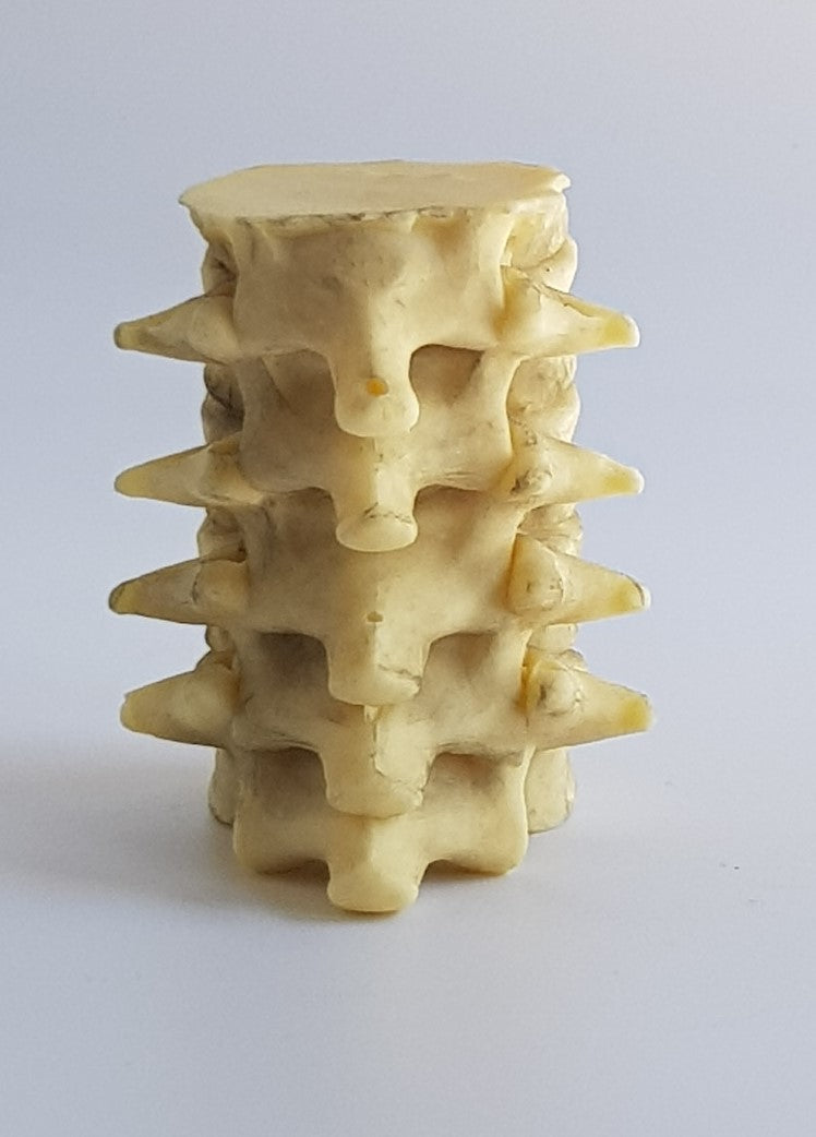 Spine